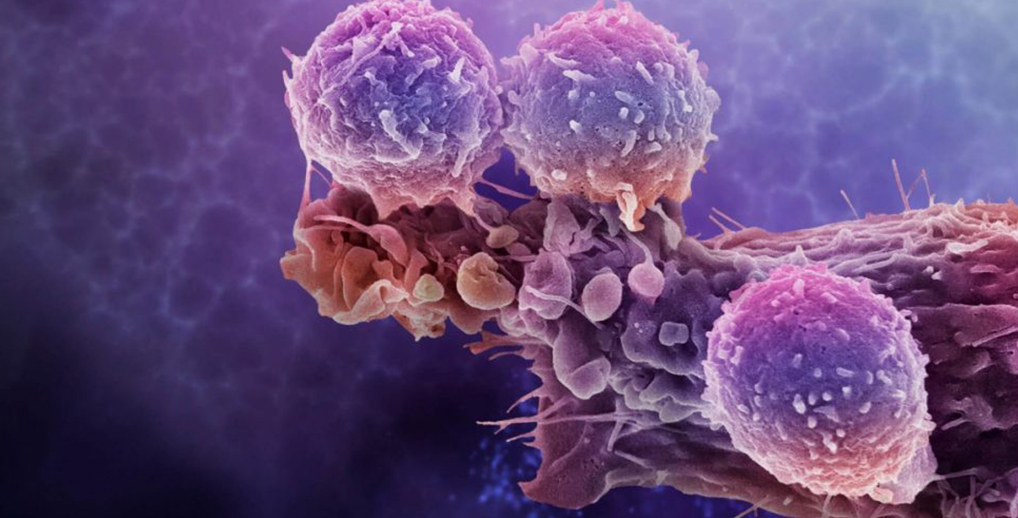 Nk cell therapy Nk cell therapy